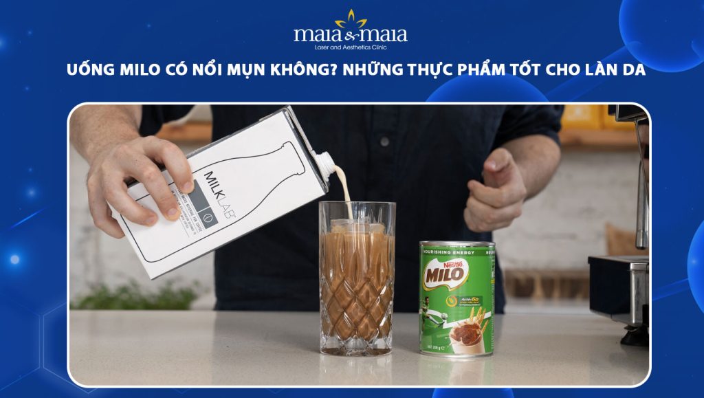 uống milo có nổi mụn không