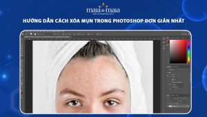 xóa mụn trong photoshop