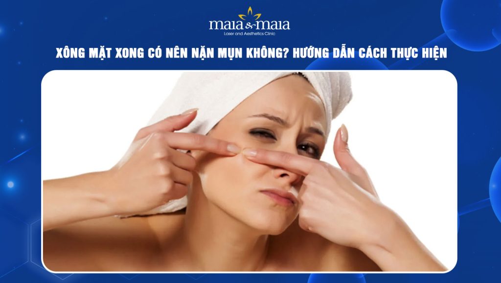 xông mặt xong có nên nặn mụn không