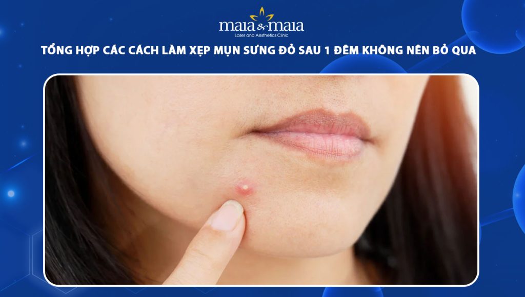 Các cách làm xẹp mụn sưng đỏ sau 1 đêm không nên bỏ qua 1 cách làm xẹp mụn sưng đỏ