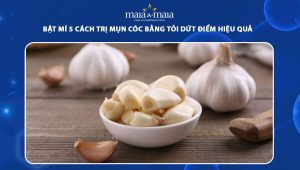 cách trị mụn cóc bằng tỏi