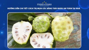 cách trị mụn cóc bằng trái nhàu