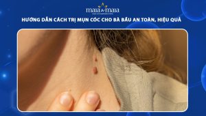 cách trị mụn cóc cho bà bầu