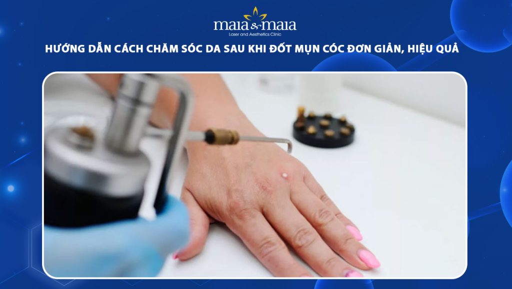 Hướng dẫn cách chăm sóc da sau khi đốt mụn cóc đơn giản 1 chăm sóc da sau khi đốt mụn cóc
