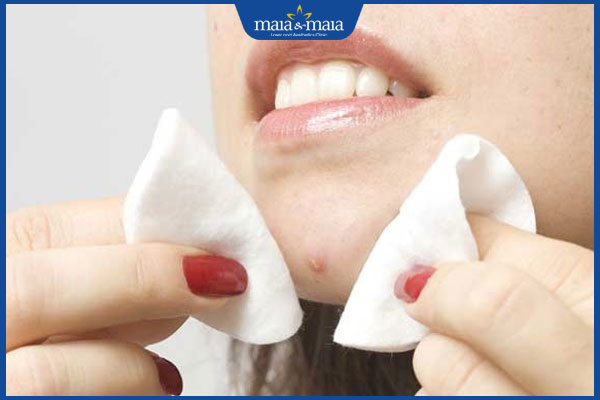 cồi mụn đã chín