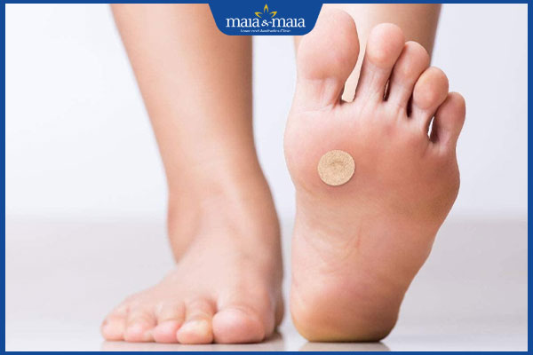 Miếng dán mụn cóc là gì? Sử dụng loại nào tốt? 2 dán miếng dán trị mụn cóc