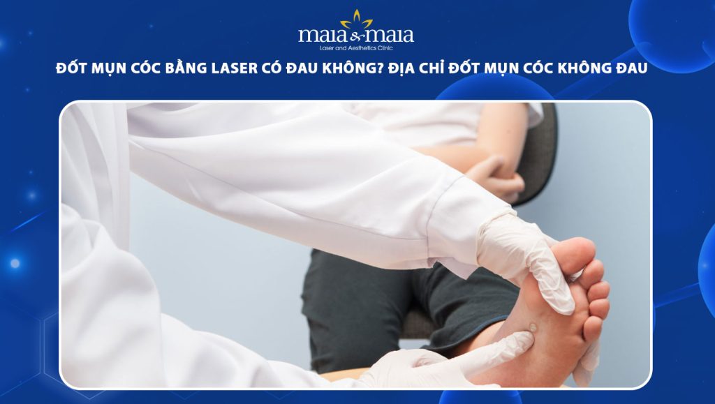 đốt mụn cóc bằng laser có đau không