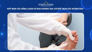 đốt mụn cóc bằng laser có đau không