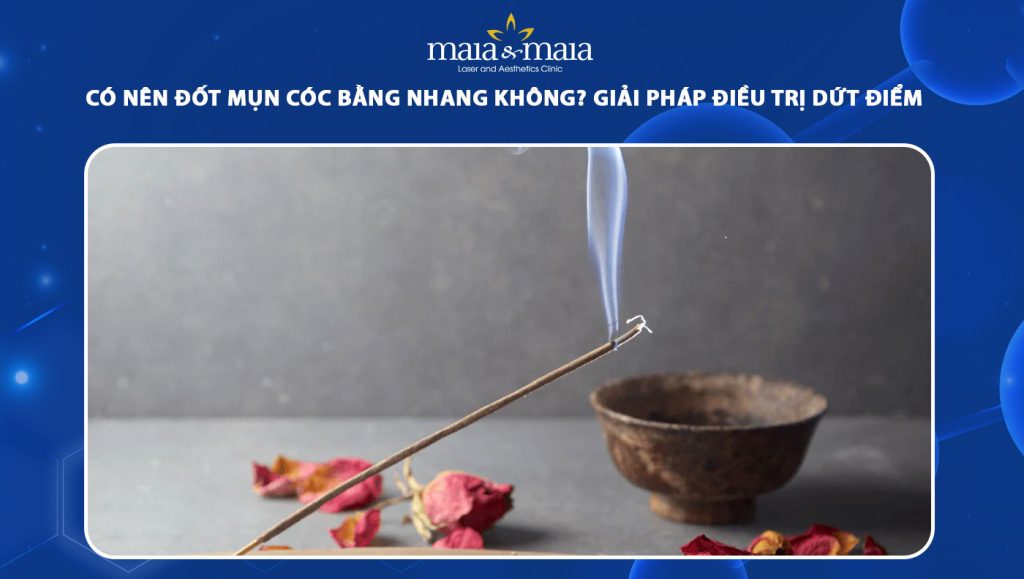 đốt mụn cóc bằng nhang