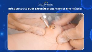 đốt mụn cóc có được bảo hiểm không