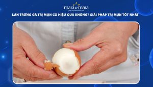 lăn trứng gà trị mụn