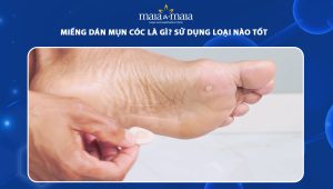 miếng dán mụn cóc
