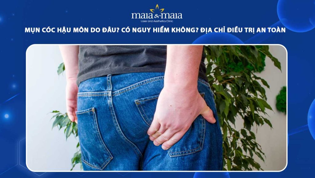 mụn cóc hậu môn