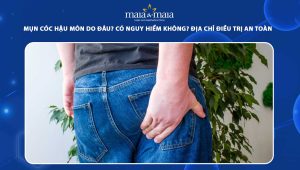 mụn cóc hậu môn