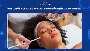 peel da đẩy mụn trong bao lâu