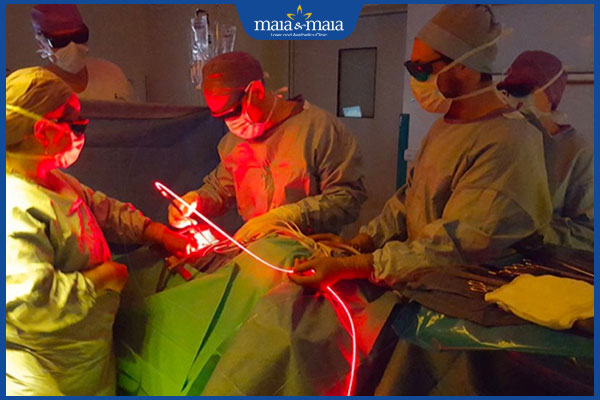 phương pháp ALA-PDT trị mụn cóc sinh dục