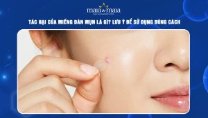 tác hại của miếng dán mụn