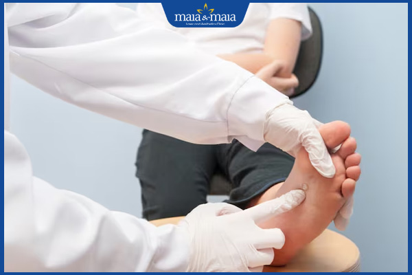 thăm khám bác sĩ khi bị mụn cóc