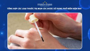 thuốc trị mụn cóc