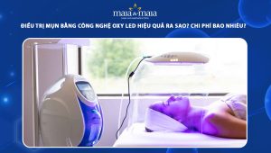 trị mụn bằng công nghệ oxy led