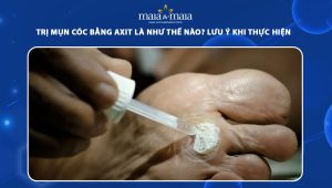 trị mụn cóc bằng axit