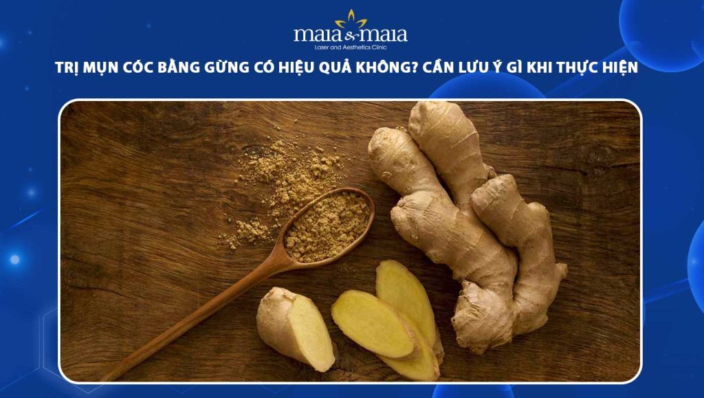 trị mụn cóc bằng gừng