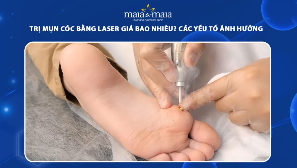 trị mụn cóc bằng laser giá bao nhiêu