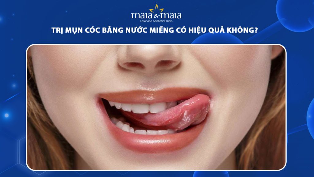 Trị mụn cóc bằng nước miếng có hiệu quả không? 1 trị mụn cóc bằng nước miếng