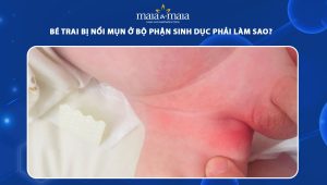 bé trai bị nổi mụn ở bộ phận sinh dục