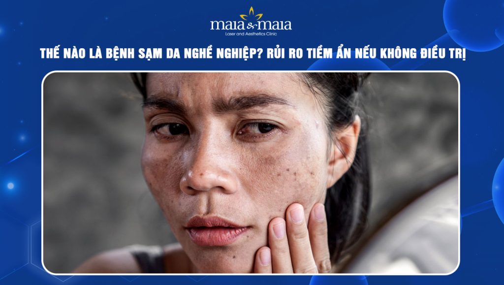 Bệnh sạm da nghề nghiệp