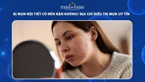bị mụn nội tiết có nên nặn không