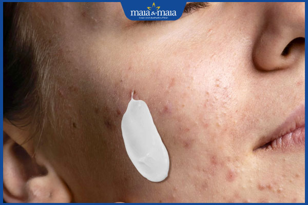 bôi kem chống nắng che mụn