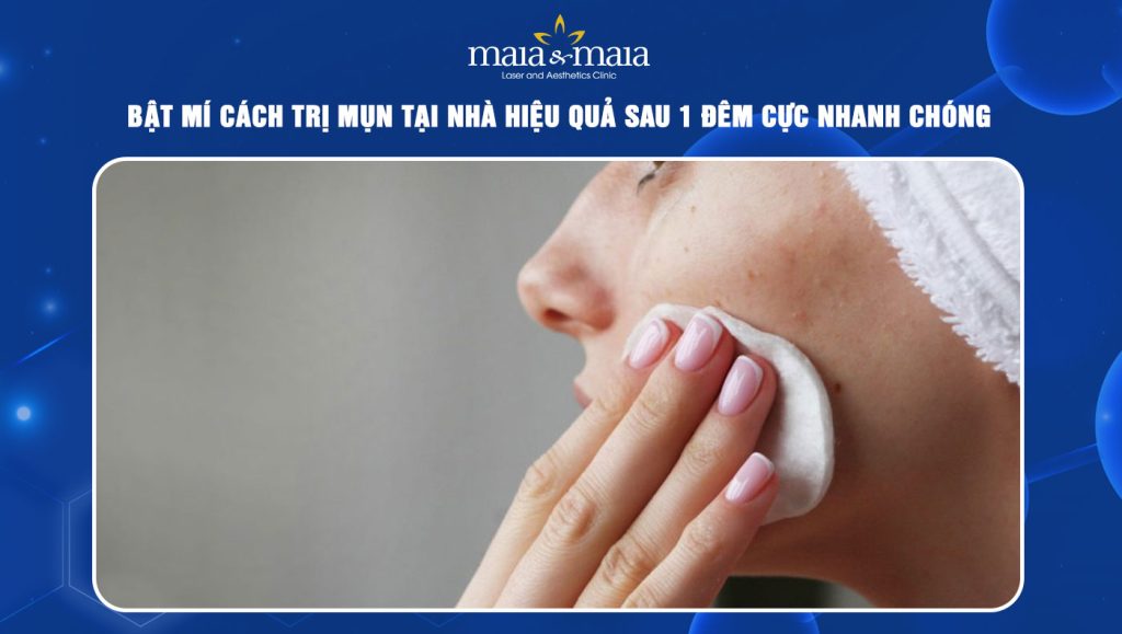 Bật mí 8 cách trị mụn tại nhà hiệu quả sau 1 đêm cực nhanh 1 cách trị mụn tại nhà hiệu quả sau 1 đêm