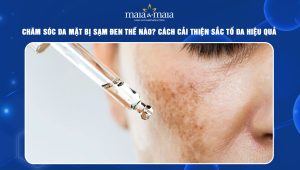 Chăm sóc da mặt bị sạm đen