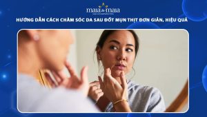 chăm sóc da sau đốt mụn thịt