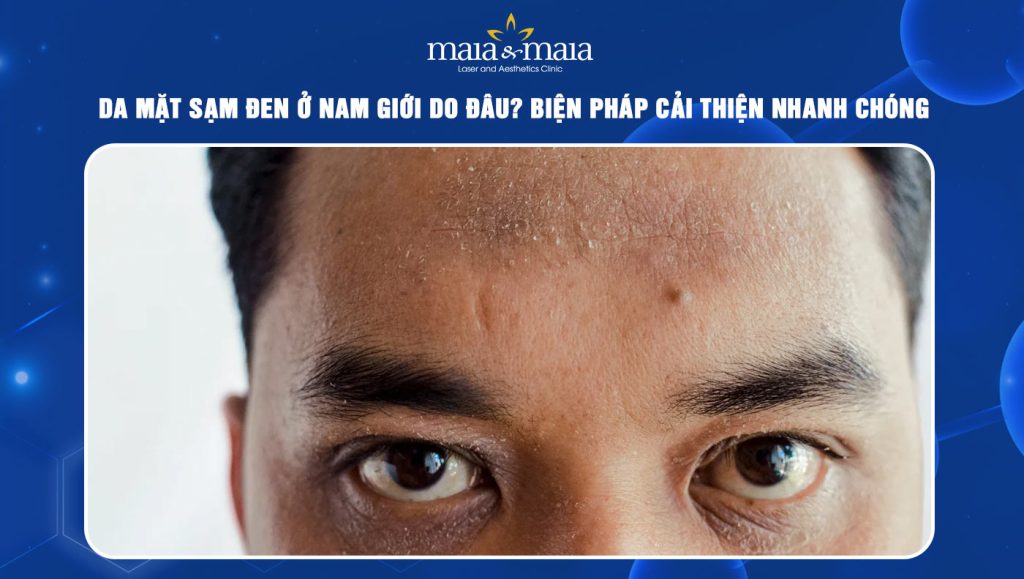 Da mặt sạm đen ở nam giới do đâu? Cách cải thiện hiệu quả 1 Da mặt sạm đen ở nam giới