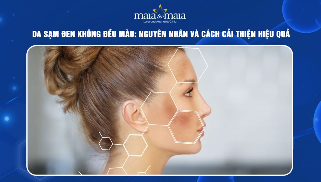 Da sạm đen không đều màu: Nguyên nhân và cách cải thiện 1 Da sạm đen không đều màu