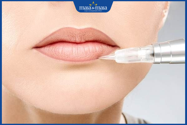 đào thải mực phun