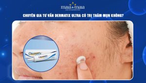 Dermatix Ultra có trị thâm mụn không