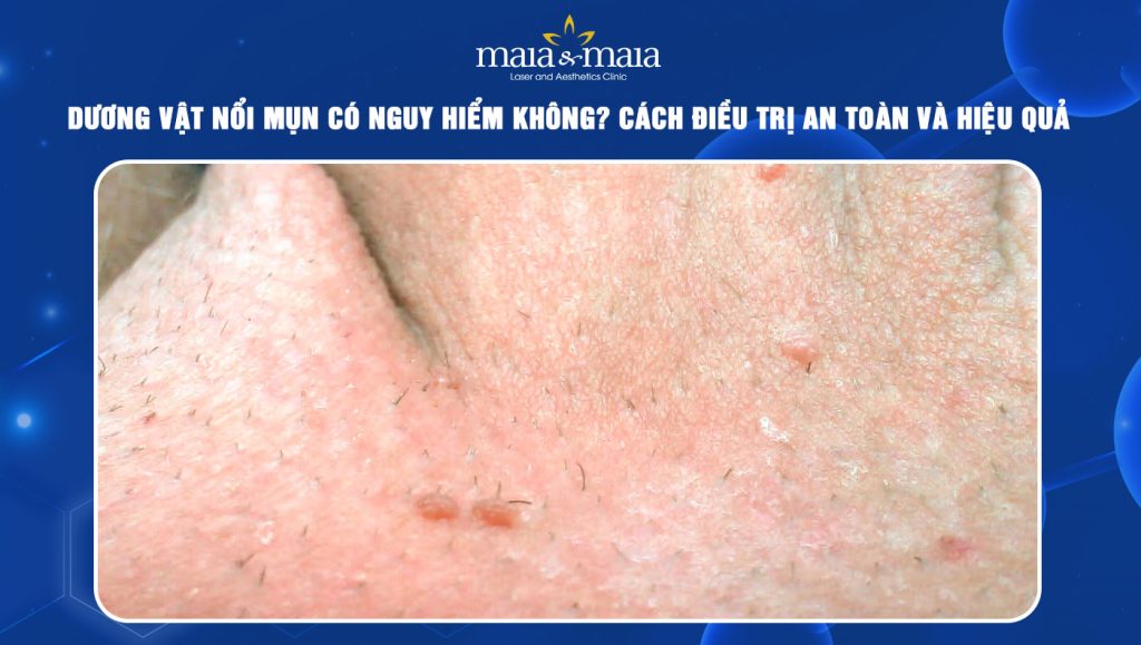 Dương vật nổi mụn có nguy hiểm không? Cách điều trị an toàn 1 Dương vật nổi mụn