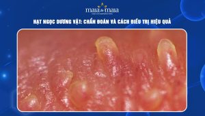 hạt ngọc dương vật