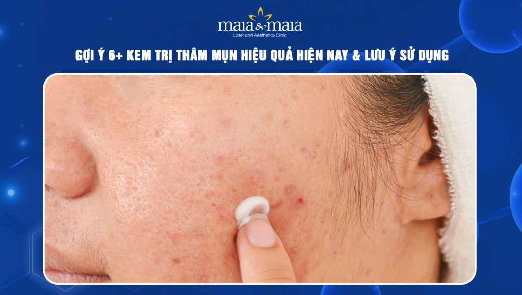 kem trị thâm mụn