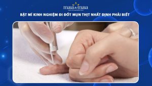 kinh nghiệm đi đốt mụn thịt