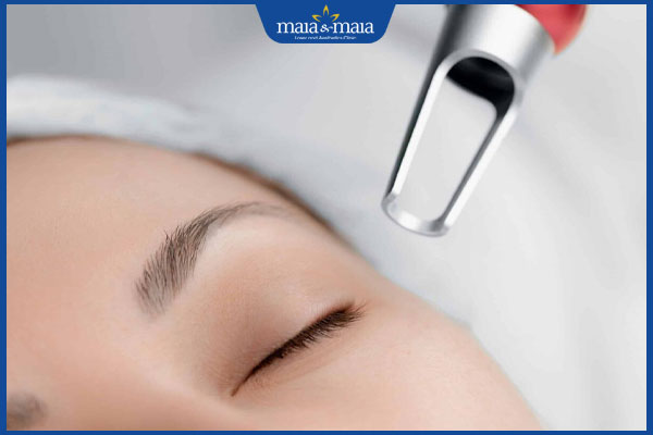 laser trị mụn gạo ở mắt