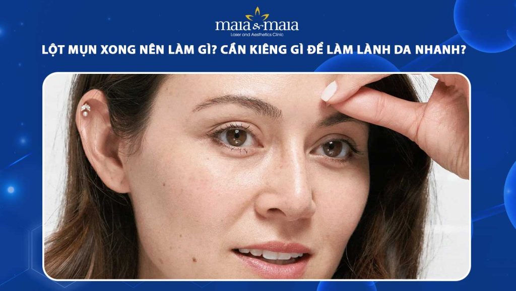 lột mụn xong nên làm gì