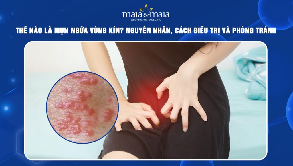 Mụn ngứa vùng kín là như nào? Cách điều trị và phòng tránh 1 Mụn ngứa vùng kín