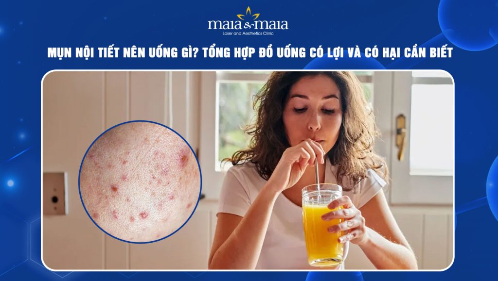 Mụn nội tiết nên uống gì? Tổng hợp đồ uống có lợi và có hại 1 mụn nội tiết nên uống gì