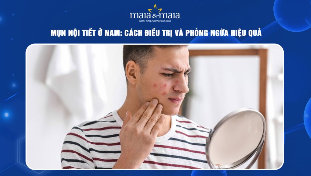 Mụn nội tiết ở nam: Cách điều trị và phòng ngừa hiệu quả 1 Mụn nội tiết ở nam