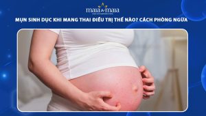 mụn sinh dục khi mang thai