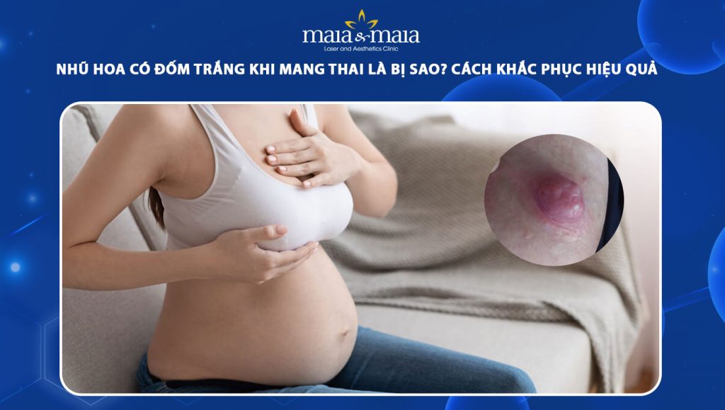 nhũ hoa có đốm trắng khi mang thai